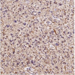 Tripartite Motif-Containing Protein 44 (TRIM44) Antibody
