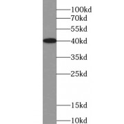 WB analysis of human heart tissue, using TRIM54 antibody (1/500 dilution).