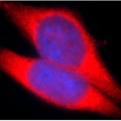 E3 Ubiquitin-Protein Ligase TRIM63 (TRIM63) Antibody