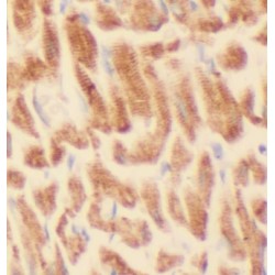 E3 Ubiquitin-Protein Ligase TRIM63 (TRIM63) Antibody