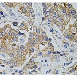 Transient Receptor Potential Cation Channel Subfamily A Member 1 (TRPA1) Antibody
