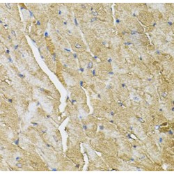 Transient Receptor Potential Cation Channel Subfamily C Member 1 (TRPC1) Antibody