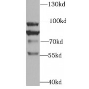 WB analysis of SH-SY5Y cells, using TRPV4 antibody (1/800 dilution).