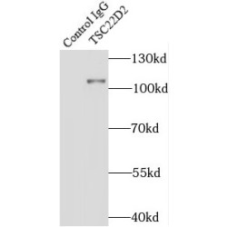 TSC22 Domain Family Protein 2 (TSC22D2) Antibody