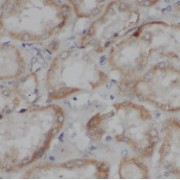 IHC-P analysis of human kidney tissue, using TSLP antibody (1/50 dilution).