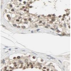 Translin-Associated Factor X-Interacting Protein 1 (TSNAXIP1) Antibody