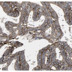 Protease, Serine 50 (TSP50) Antibody