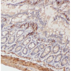 Tetraspanin 1 (TSPAN1) Antibody