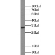 WB analysis of human ovary cancer, using TSPAN15 antibody (1/500 dilution).