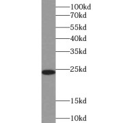 WB analysis of HeLa cells, using TSR2 antibody (1/400 dilution).