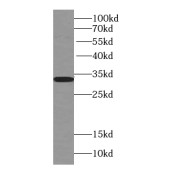 WB analysis of rat brain tissue, using TST antibody (1/1000 dilution).