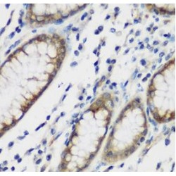 Tau-Tubulin Kinase 2 (TTBK2) Antibody