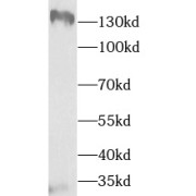 WB analysis of PC-3 cells, using TTBK2 antibody (1/1000 dilution).