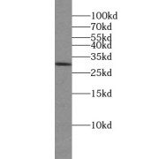 WB analysis of mouse testis tissue, using TTC32 antibody (1/300 dilution).
