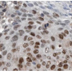 Transcription Termination Factor 1 (TTF1) Antibody