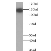 WB analysis of A2780 cells, using TTF2 antibody (1/500 dilution).