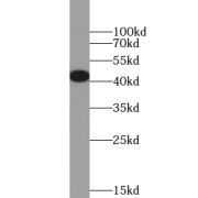 WB analysis of SH-SY5Y cells, using TTL antibody (1/1000 dilution).