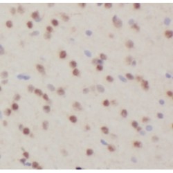 Tubby Protein Homolog (TUB) Antibody
