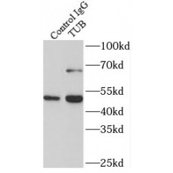 Tubby Protein Homolog (TUB) Antibody