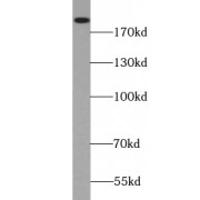 WB analysis of HEK-293 cells, using TSC2 antibody (1/300 dilution).
