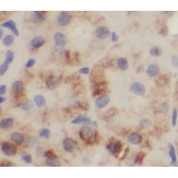 Tuberin-Specific Antibody