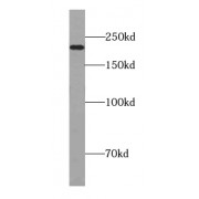 WB analysis of mouse lung tissue, using TSC2-Specific antibody (1/300 dilution).