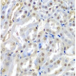 Tumor Suppressor Candidate 2 (TUSC2) Antibody
