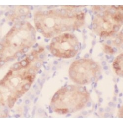 Thioredoxin-Interacting Protein (TXNIP) Antibody