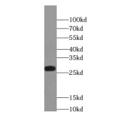 WB analysis of mouse brain tissue, using TXNL6 antibody (1/800 dilution).