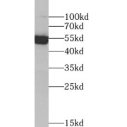 WB analysis of HepG2 cells, using TXNRD2 antibody (1/1000 dilution).