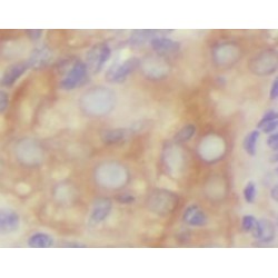 S-Adenosyl-L-Methionine-Dependent tRNA 4-Demethylwyosine Synthase (TYW1B) Antibody