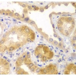 Ubiquitin-Like Modifier-Activating Enzyme 6 (UBA6) Antibody