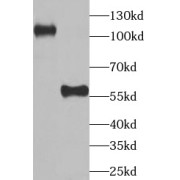 WB analysis of human brain tissue, using UBA6 antibody (1/1000 dilution).