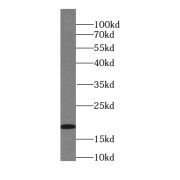 WB analysis of HEK-293 cells, using UBE2I-Specific antibody (1/400 dilution).