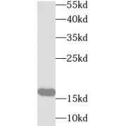 WB analysis of L02 cells, using UBE2B antibody (1/1000 dilution).