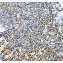 UBE2D1-Specific Antibody