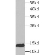 WB analysis of mouse thymus tissue, using UBE2D1 antibody (1/1000 dilution).