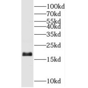 WB analysis of Jurkat cells, using UBE2G2 antibody (1/300 dilution).