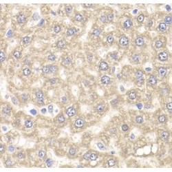 Ubiquitin-Conjugating Enzyme E2 J2 (UBE2J2) Antibody