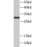 WB analysis of mouse liver tissue, using UBE2J2 antibody (1/1000 dilution).