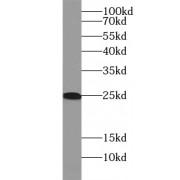 WB analysis of human brain tissue, using UBE2K antibody (1/500 dilution).