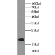WB analysis of Jurkat cells, using UBE2L6 antibody (1/1000 dilution).