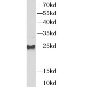 WB analysis of MDA-MB-453s cells, using UBE2S antibody (1/1000 dilution).