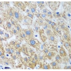 Ubiquitin-Conjugating Enzyme E2 U (UBE2U) Antibody