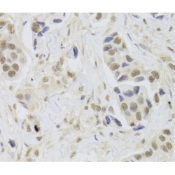 Ubiquitin-Protein Ligase E3C (UBE3C) Antibody