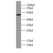 WB analysis of PC-3 cells, using UBXN6 antibody (1/1200 dilution).
