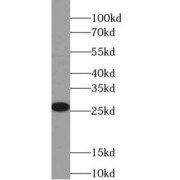 abx239217