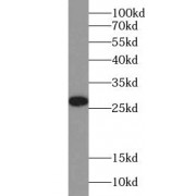 WB analysis of A549 cells, using UCHL1 antibody (1/3000 dilution).
