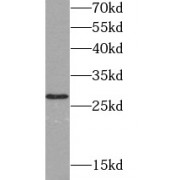 WB analysis of HeLa cells, using UCHL3 antibody (1/1000 dilution).