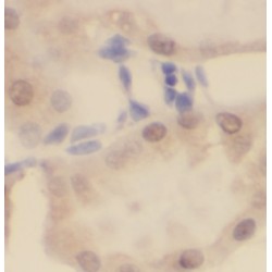 Uridine-Cytidine Kinase-Like 1 (UCKL1) Antibody